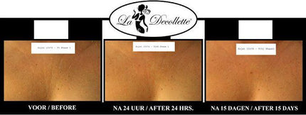 La Decollette